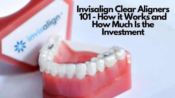Invisalign Clear Aligners 101