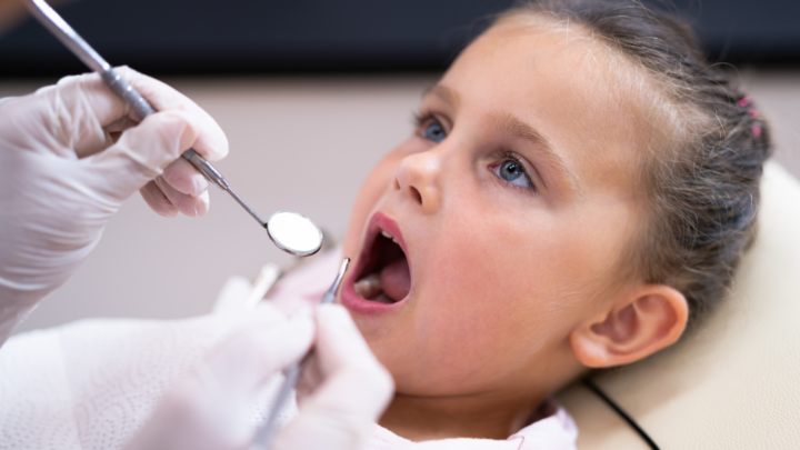 Frequently Asked Questions About Dental Checkups