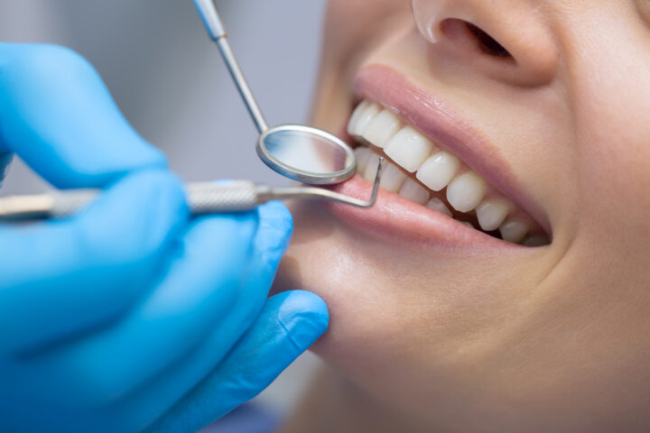 Common Questions Asked About Cosmetic Dentistry Palos Park