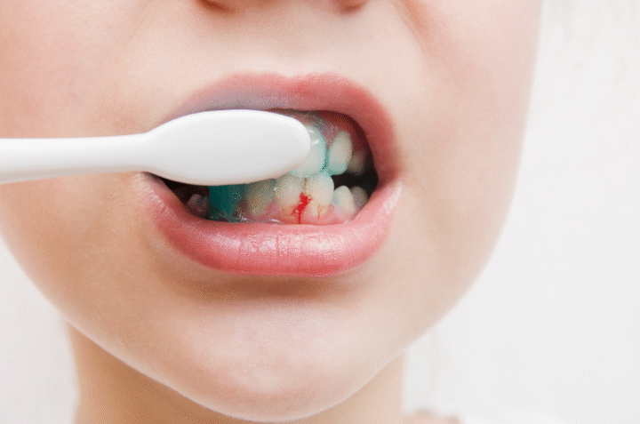 periodontal disease treatment services near palos park IL